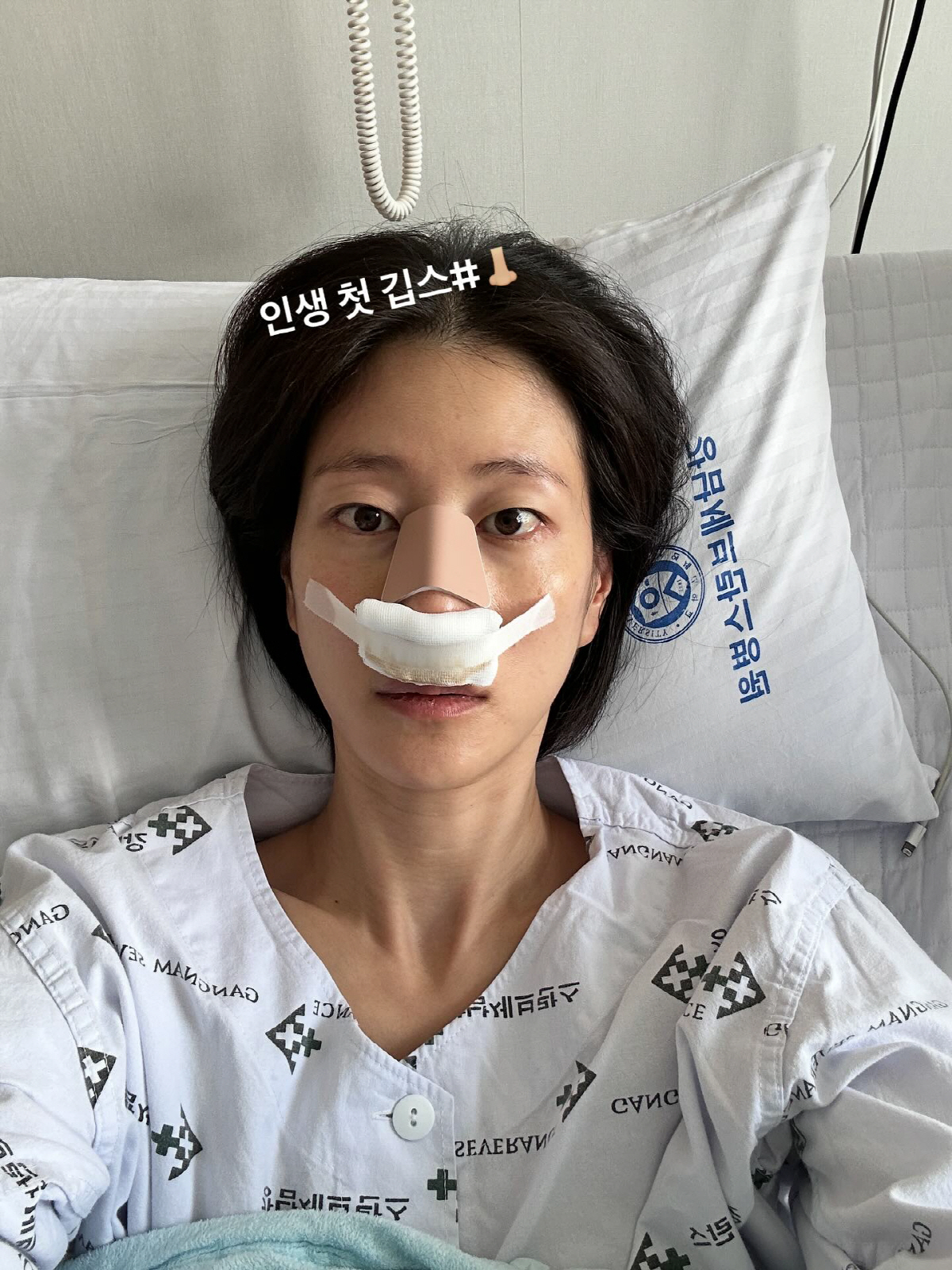 이현이, '코 수술' 실시간 공개…"예전 코로 돌아왔다"[SCin스타]
