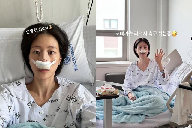‘골때녀’ 이현이, 축구 경기 중 코뼈 골절 “숨도 못 쉬어”[SCin스…