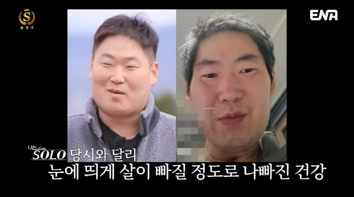 '사망설' 19기 영철 "뇌출혈로 쓰러져 구토"..30kg나 빠진 근황