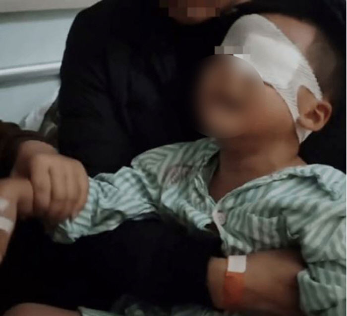 눈 다친 유치원생에 돼지기름 발라 실명…"교사 자질에 의심"