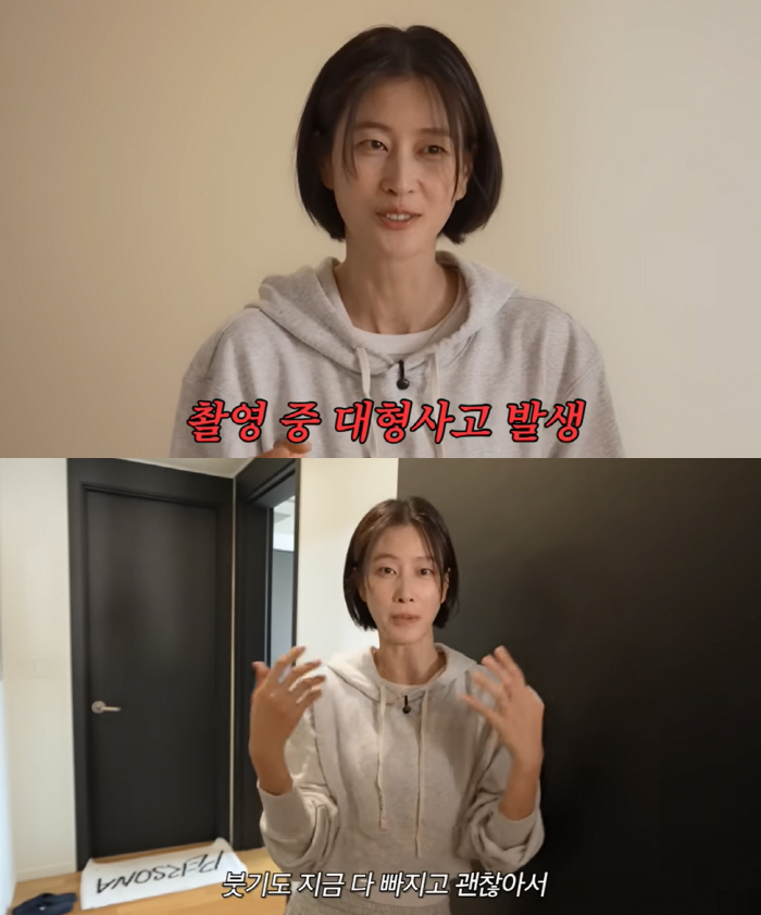 '코뼈골절' 이현이 "헤딩하면서 공만 봤다...100% 내 과실 맞아"