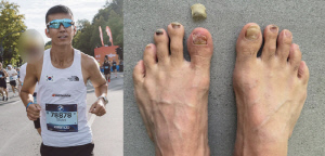 '정혜영♥' 션, 충격적인 발 상태...