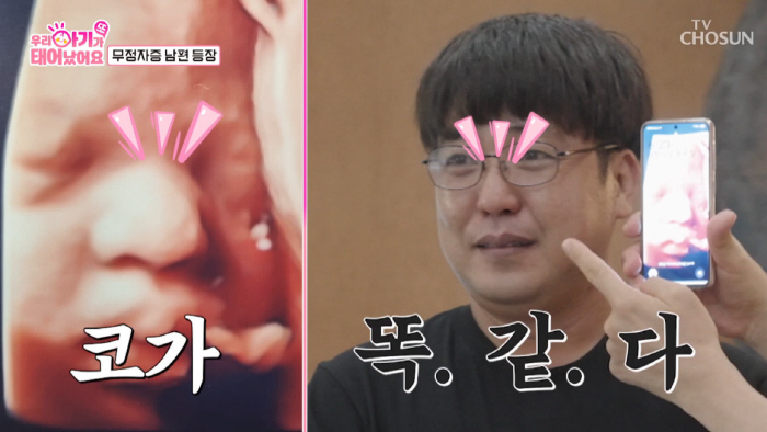 '무정자증' 남편, 40대 아내 18년만 임신에..."결혼 21년만 큰 …