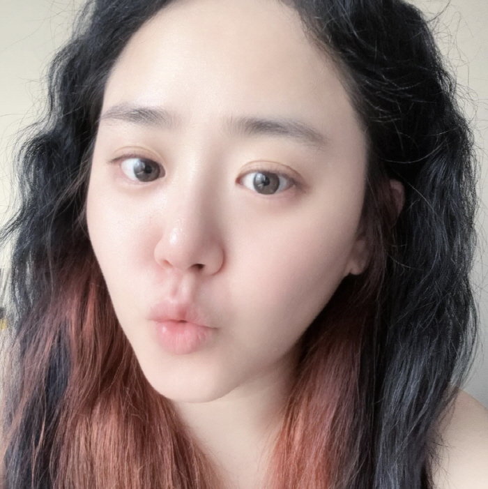 '희소병 완치' 37세 문근영, 다이어트 한다더니..7개월 만에 달라졌다
