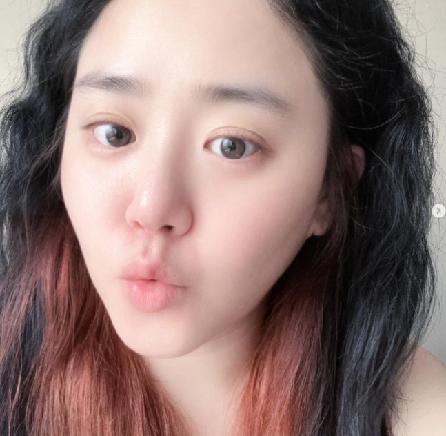 급성구획증후군 완치판정 받은 문근영, 곱슬머리 러블리 근황…여전한 동안 …