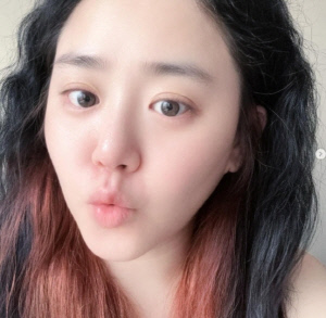 급성구획증후군 완치판정 받은 문근영, 곱슬머리 러블리 근황…여전한 동안 매력[SCin스타]