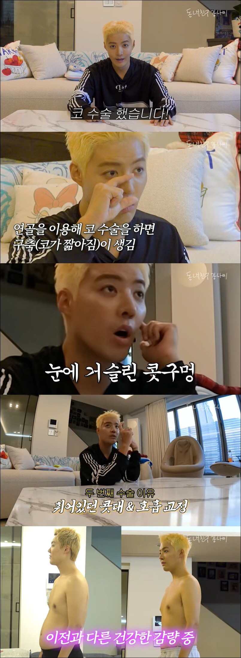 '이상화♥' 강남, 코 재수술에 13kg 감량 성공 "구축 와 콧구멍밖에…