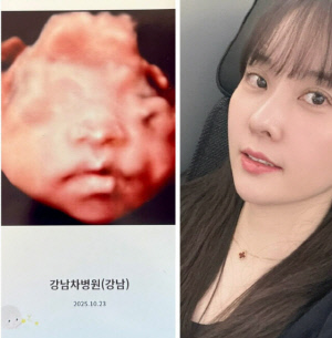 '9번 시험관 끝 기적' 양현민♥최참사랑, 딸 초음파 공개…