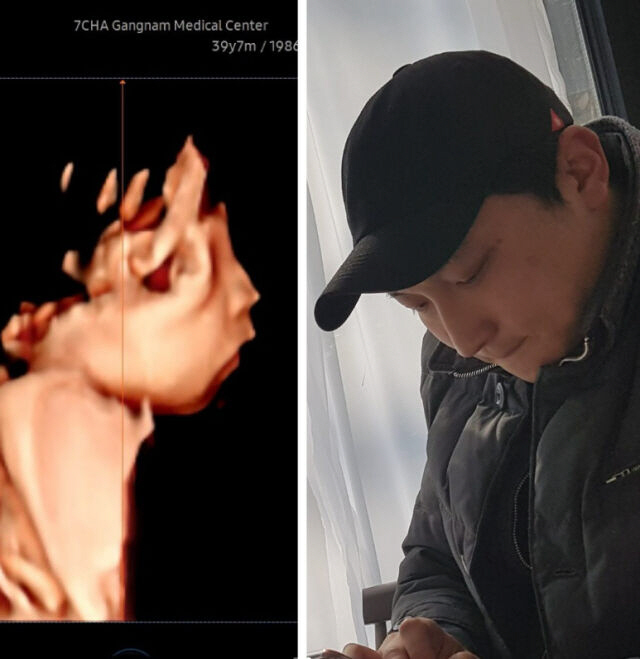 '9번 시험관 끝 기적' 양현민♥최참사랑, 딸 초음파 공개…"엄마 닮으렴…