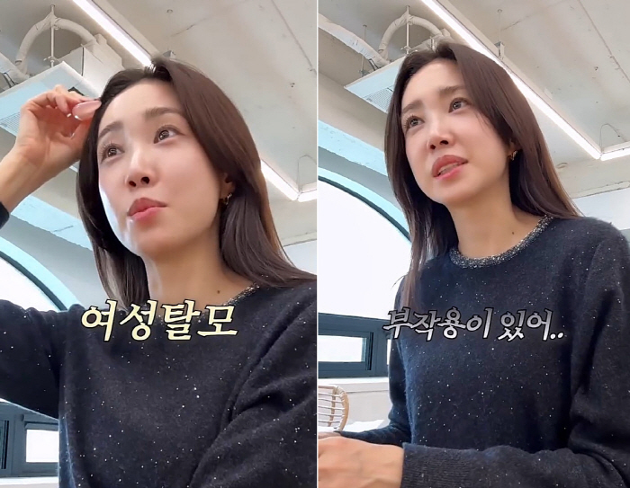 '39세' 최희, 여성 탈모 진단 받았다..."머리가 우수수수 빠져"