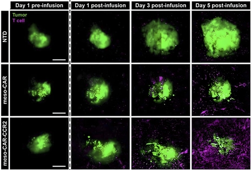 체외 미세 칩으로 폐암 등 고형암 치료 효과 예측한다