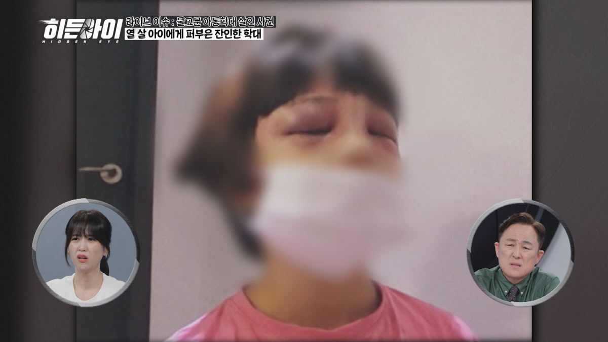 경찰 앞에서 바지 벗어던져→도로 한복판 질주 알몸男 만행 CCTV에 '경…