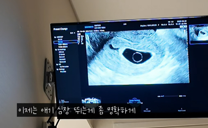 “아기 심장 안 뛰어”…로빈♥김서연 기적 같은 임신 2주만 비보 '눈물'…