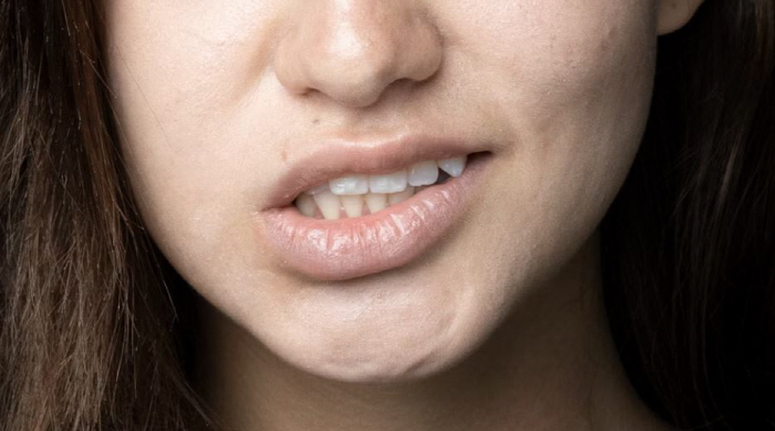 10월 29일은 '세계 뇌졸중의 날'…'이웃, 손, 발, 시선'보면 안다