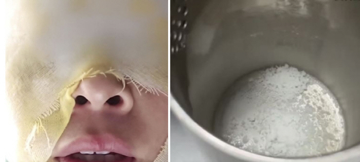 "물때 제거하려다" 온라인 청소법 따라 하다 폭발로 얼굴 화상