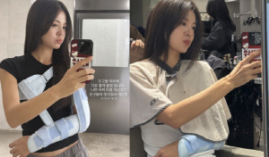 '정조국♥' 김성은, 심한 부상 당했다...팔 깁스 후 