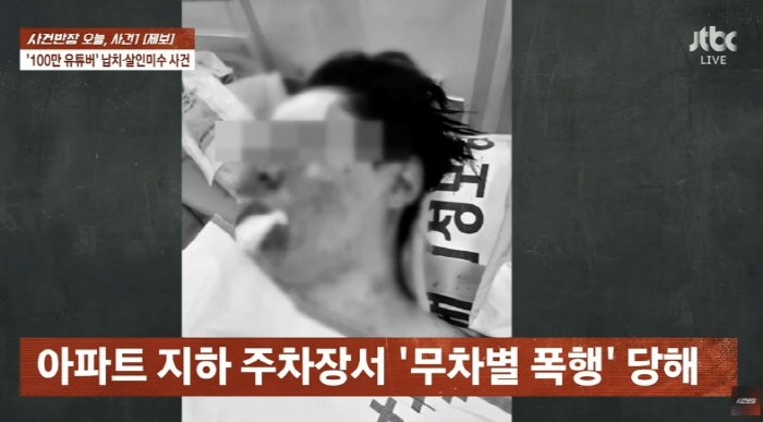 '100만 유튜버' 수탉, 무차별 폭행 피해사진 공개…장기밀매 협박까지