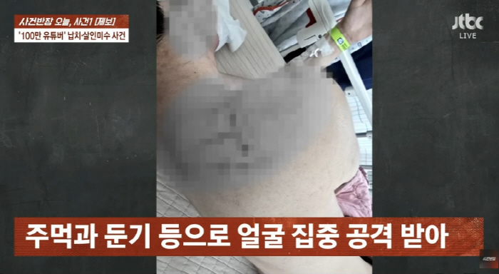 '100만 유튜버' 수탉, 무차별 폭행 피해사진 공개…장기밀매 협박까지