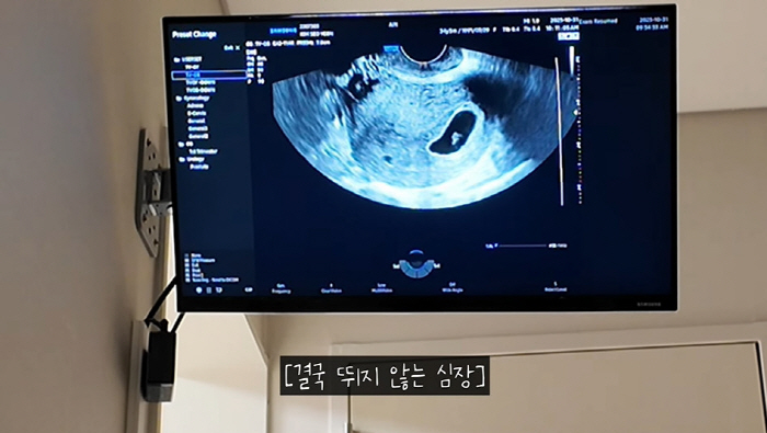 로빈♥김서연, '계류유산' 수술 후 오열..."심장이 뛰지 않아" ('로…