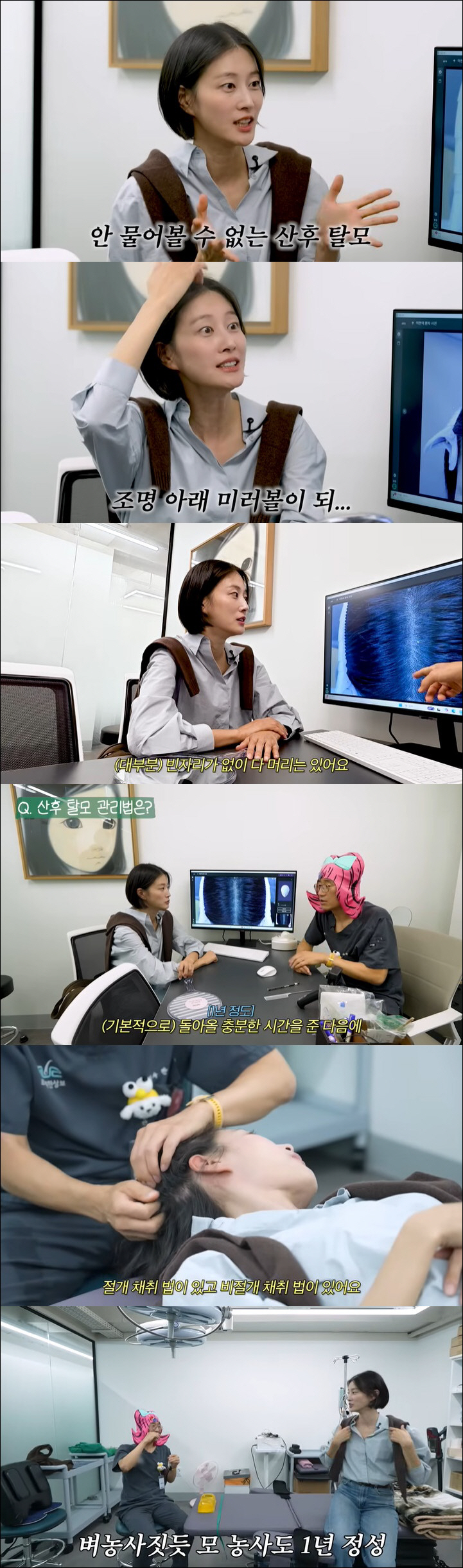 이현이, 산후 탈모에 결국 수술대 누웠다 "다음 생엔 흑인으로" ('워킹…