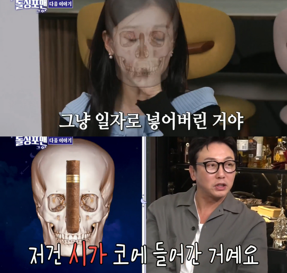 박소영, 성형 후 두개골에 저게 뭐야?..“실리콘 툭 넣어”