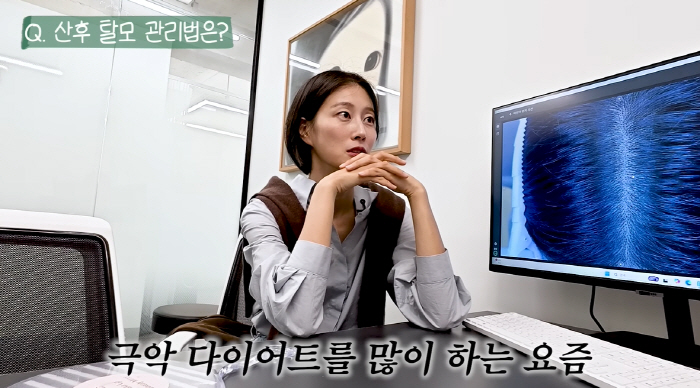 한상보, '탈모 시술'로 어마어마하게 벌었다...이현이 "사실 저도 산후…