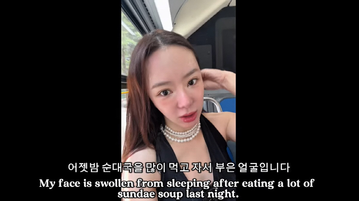 '활동중단' 서우, 미국서 퉁퉁 부은 근황 "할머니 돼 가, 인생 즐기며…