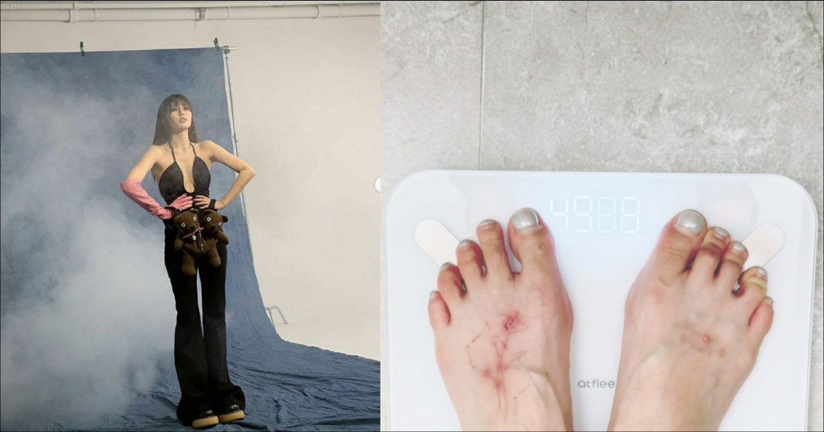 현아, 타투 지우고 10kg 감량 성공…40kg대 진입에도 "아직 멀었어…