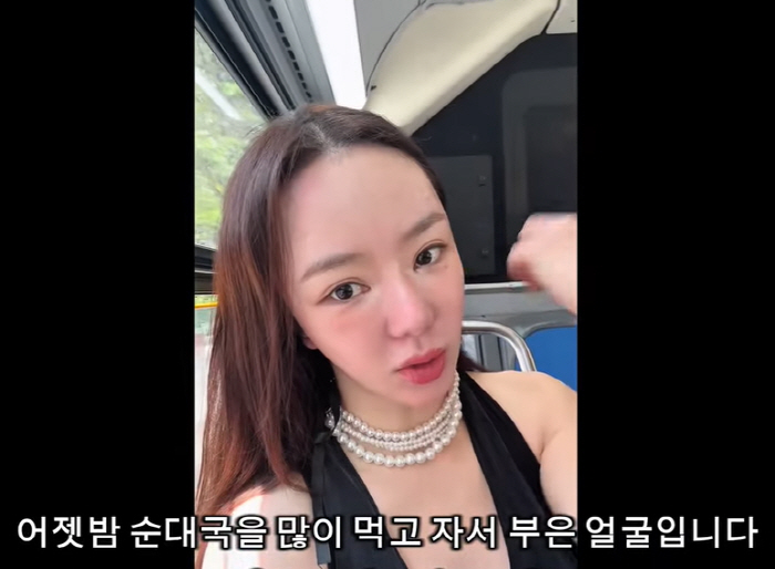 서우, 활동중단 6년만에 근황...퉁퉁 붓고 달라진 얼굴에도 "전 행복해…