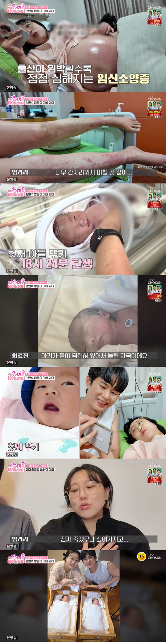 임라라, 쌍둥이 출산 후 중환자실行 "기절만 10번, 죽겠구나 싶었다"