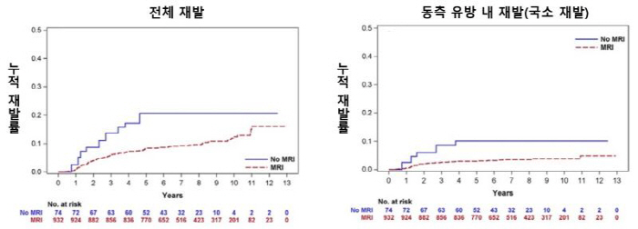 "50세 미만 유방암 환자, 수술 전 MRI 검사 시 동측 유방 내 재발…