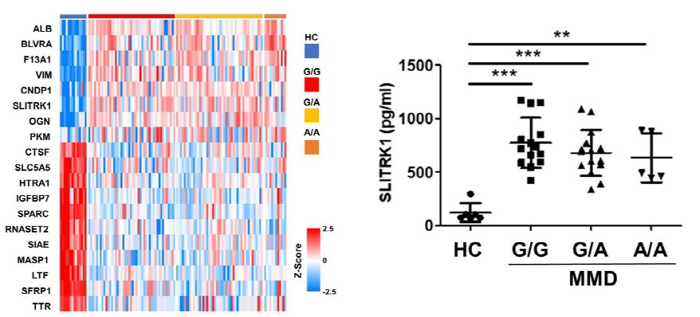 소아 모야모야병 진단·예후 예측 지표 발견…새 치료법 제시 기대