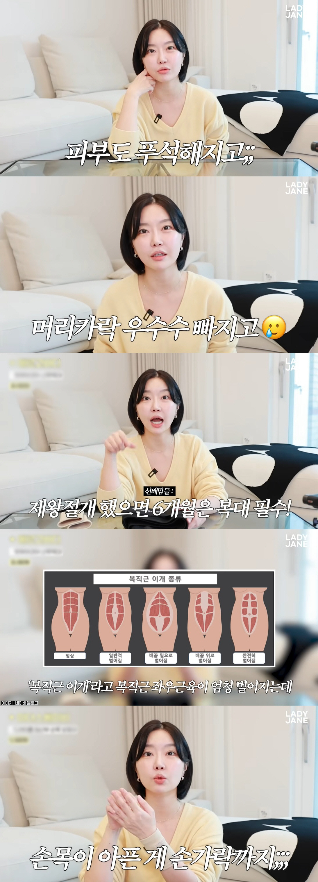 '쌍둥이 출산' 레이디제인, 제왕절개 후유증으로 고생 "배근육 벌어져 복…