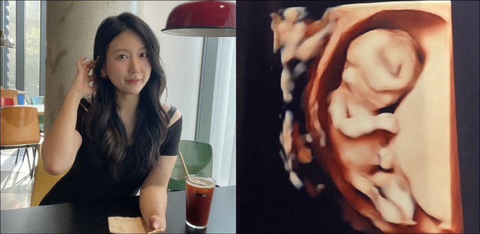 '혼전임신' 28기 정숙, '나솔이' 성별도 쿨하게 공개 "아빠 닮은 예쁜 아들"