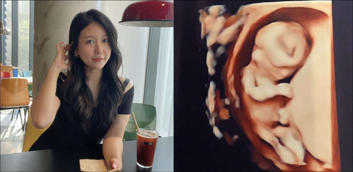 '혼전임신' 28기 정숙, '나솔이' 성별도 쿨하게 공개 "아빠 닮은 예…