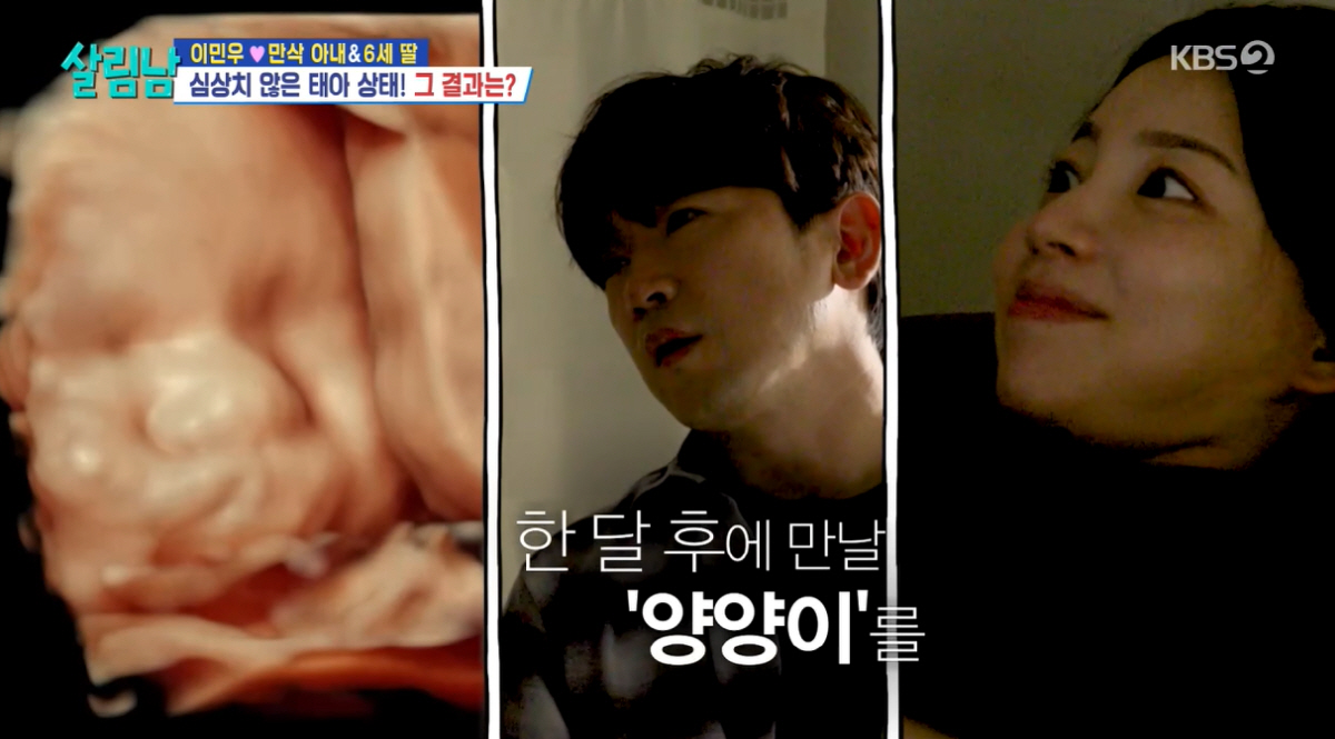 이민우♥만삭 예비아내, "아이 목덜미에 탯줄 감겨"...막달 이상 소견에…