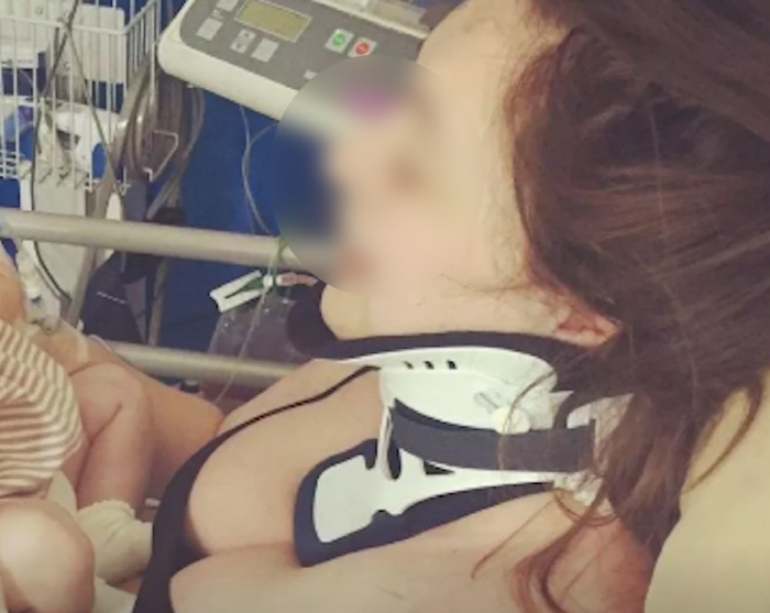 하품하다가 목숨 잃을 뻔…전기 충격처럼 온몸 '찌릿'