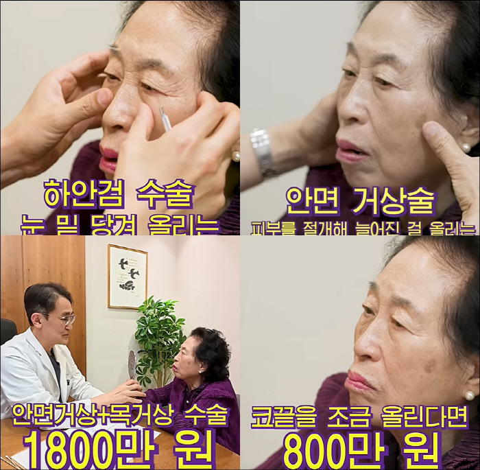 '건강이상설' 전원주, 86세에 안면거상술 결심…'3000만 원↑' 견적…