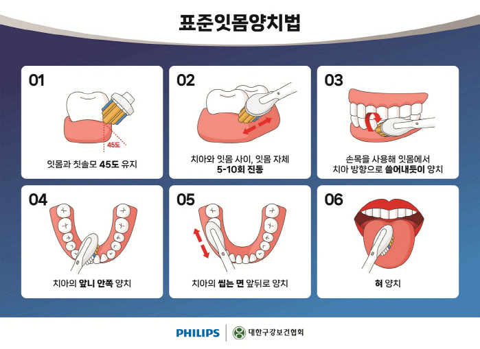 11월 12일 '세계 폐렴의 날'…흡인성 폐렴 위험 높이는 잇몸병 예방하려면?