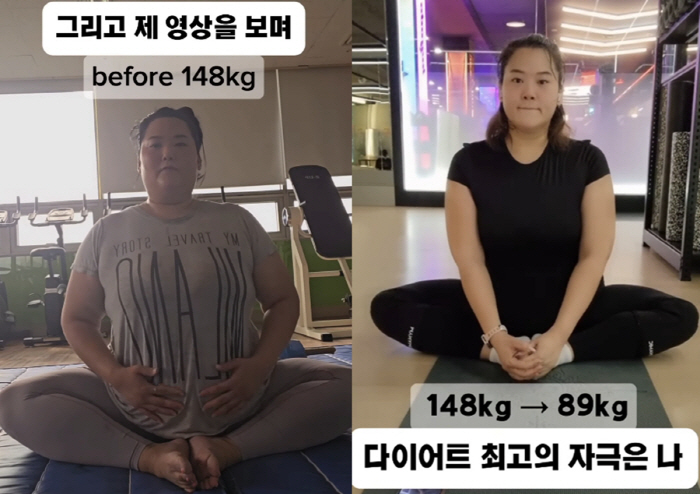 미나 시누이, '148kg→89kg' 적나라한 '비포 애프터' 공개..."최고의 성형"