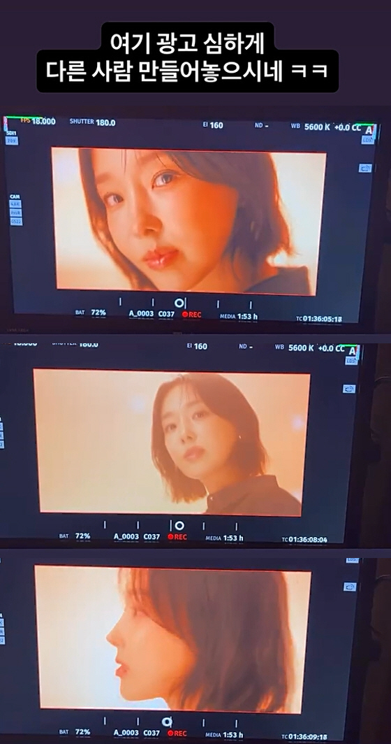 이지혜, '실리프팅' 시술 후 확 달라진 얼굴..."심하게 다른 사람 만…