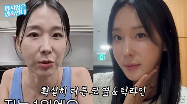 이지혜, '실리프팅' 시술 후 확 달라진 얼굴..."심하게 다른 사람 만…