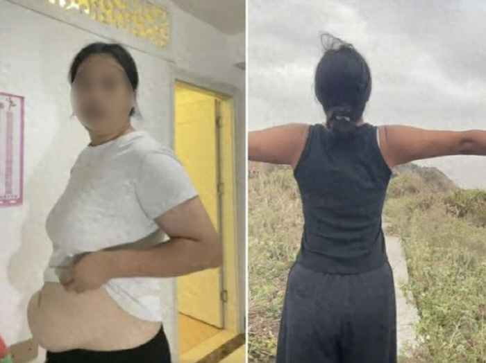 야생서 35일간 버틴 20대 여성 "14kg 감량"…"사냥한 쥐 50마리…