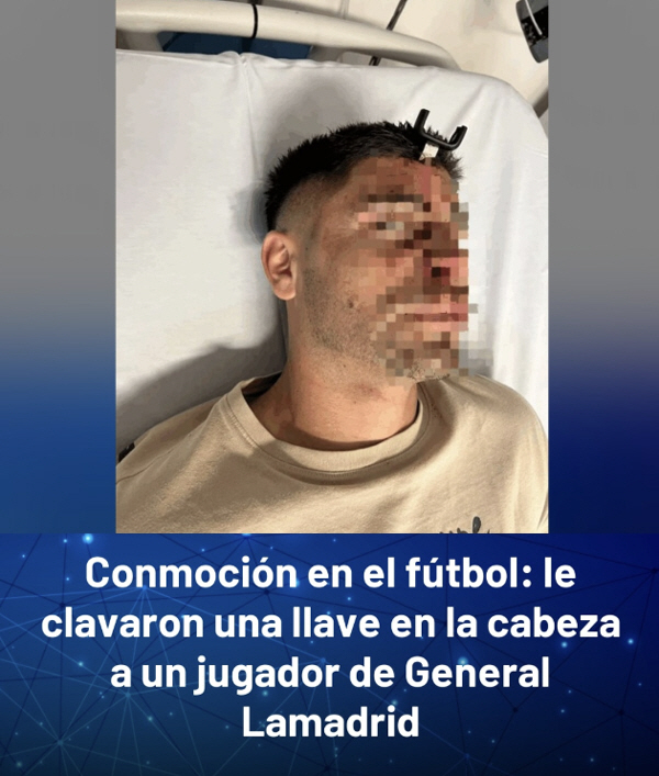 "두개골에 차키가 박혔다" 남미 축구계, 아르헨 스타 폭행 사건에 '경악…