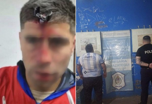 "두개골에 차키가 박혔다" 남미 축구계, 아르헨 스타 폭행 사건에 '경악…