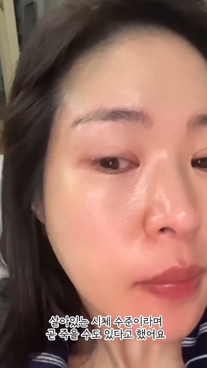 '80kg → 48kg' 미자, '극단적 다이어트'로 지하철서 실신…"곧…