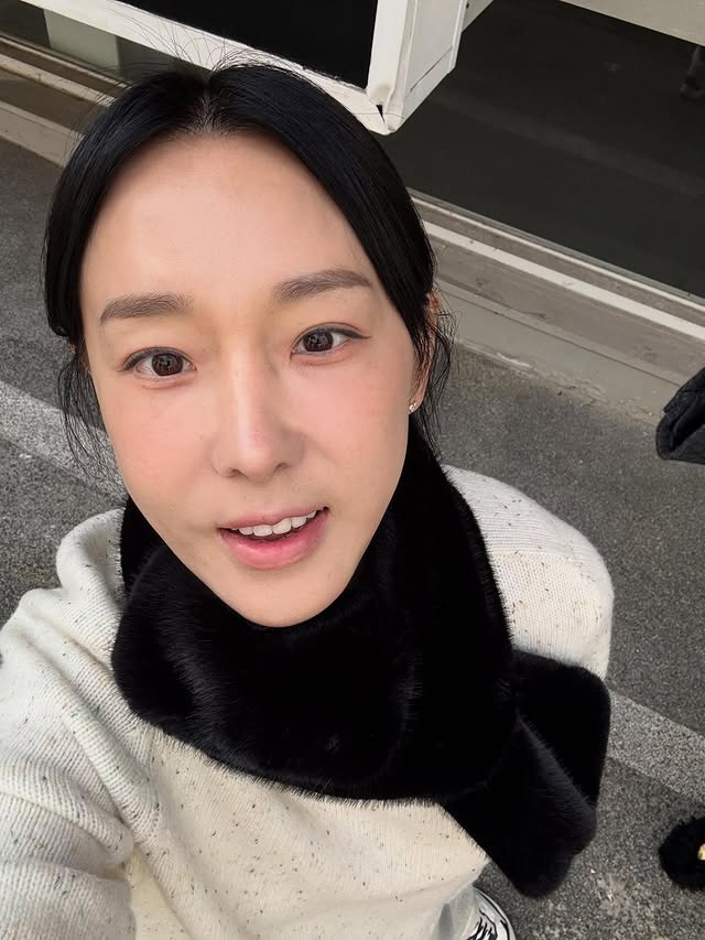 '45세' 이지혜, '인중축소·리프팅' 후 확 달라진 얼굴 "콤플렉스였다…