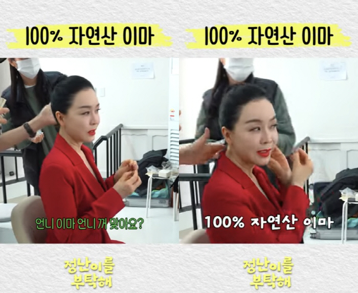 55세 김정난, 이마 어떻길래..성형 의혹 터졌다 "언니 것 맞나"