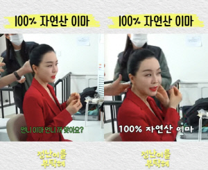 55세 김정난, 이마 어떻길래..성형 의혹 터졌다 