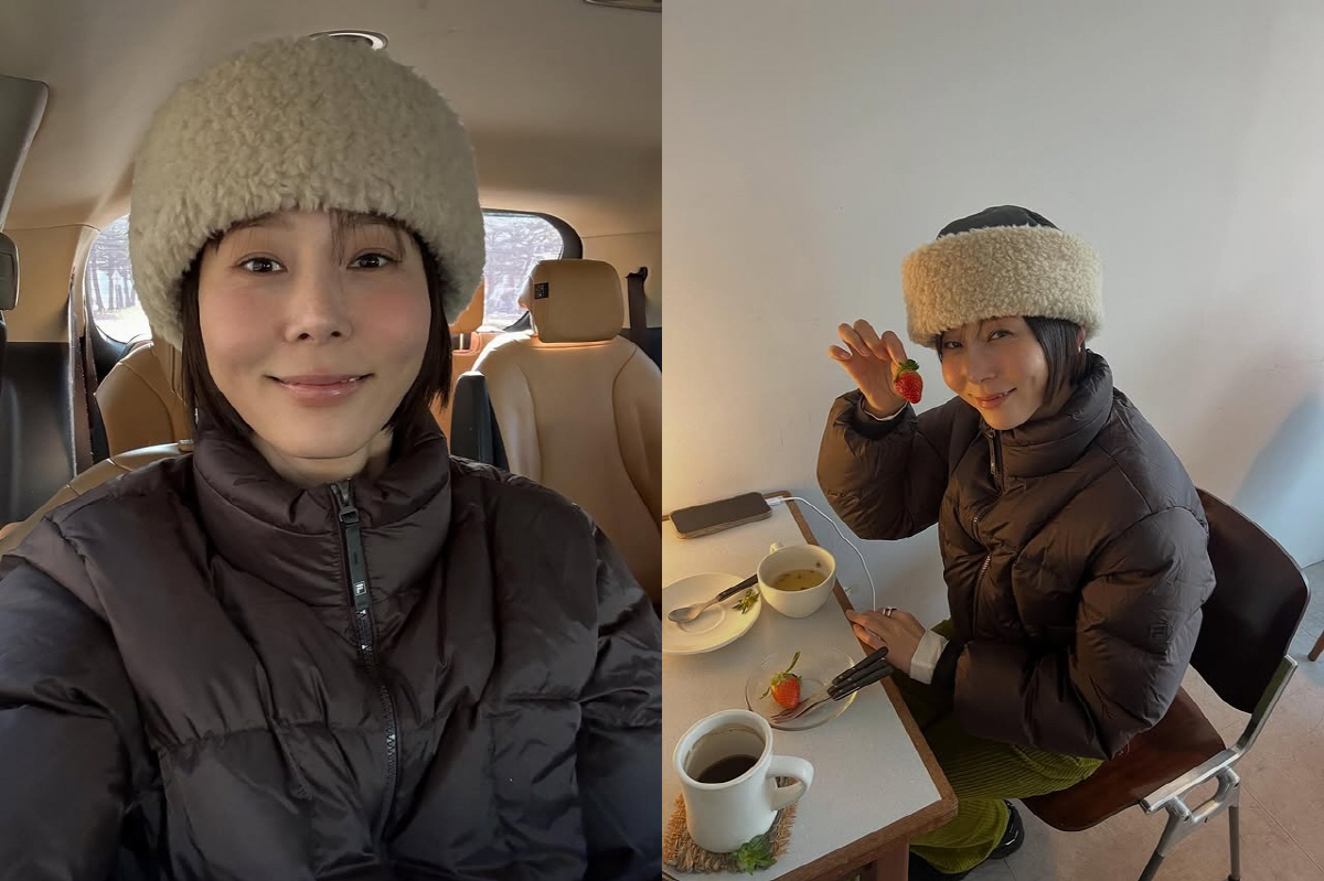 '마이큐♥' 김나영, 볼뉴머 시술 후 달라진 얼굴 "자연스럽게 예뻐졌다"